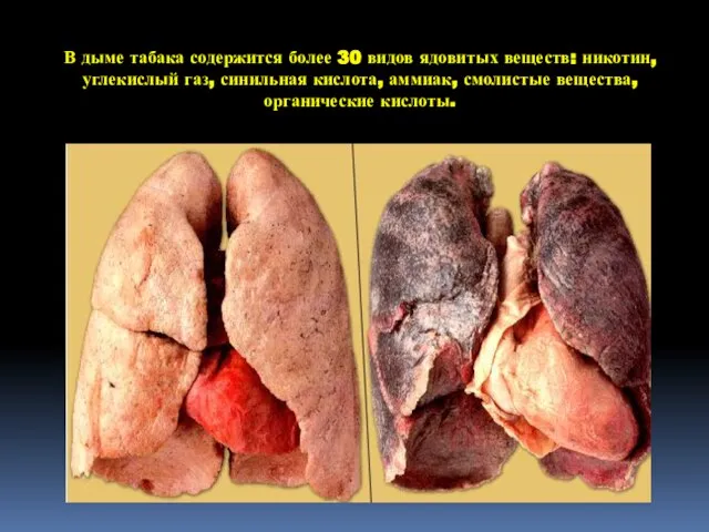 В дыме табака содержится более 30 видов ядовитых веществ: никотин, углекислый газ,