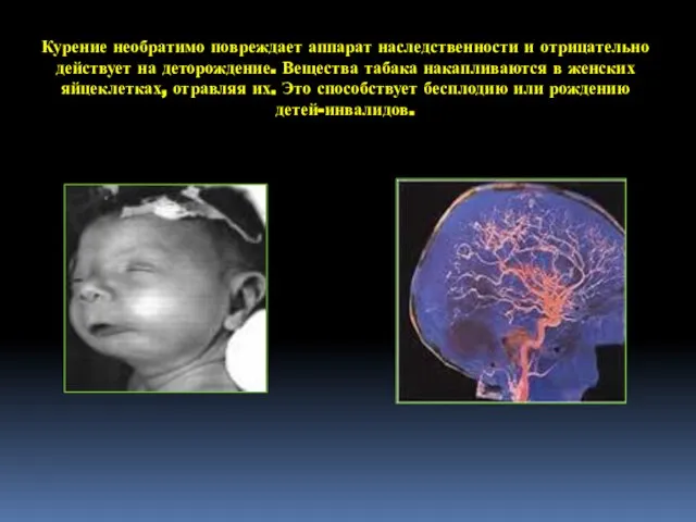 Курение необратимо повреждает аппарат наследственности и отрицательно действует на деторождение. Вещества табака