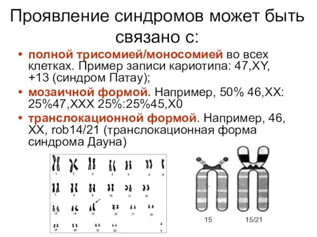 Проявление синдромов может быть связано с: полной трисомией/моносомией во всех клетках. Пример