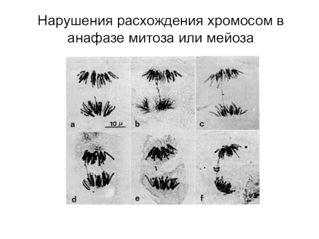 Нарушения расхождения хромосом в анафазе митоза или мейоза