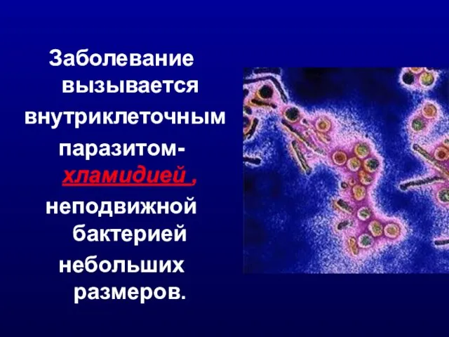 Заболевание вызывается внутриклеточным паразитом- хламидией , неподвижной бактерией небольших размеров.