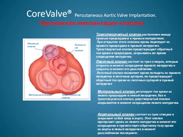 CoreValve® Percutaneous Aortic Valve Implantation. Чрезкожная имплантация клапана Лёгочный клапан Аортальный клапан