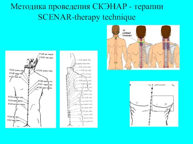 Методика проведения СКЭНАР - терапии SCENAR-therapy technique