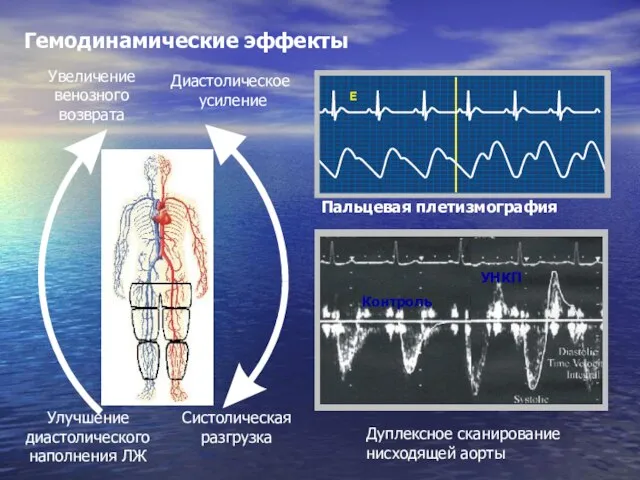 Увеличение венозного возврата Диастолическое усиление Систолическая разгрузка Дуплексное сканирование нисходящей аорты Улучшение