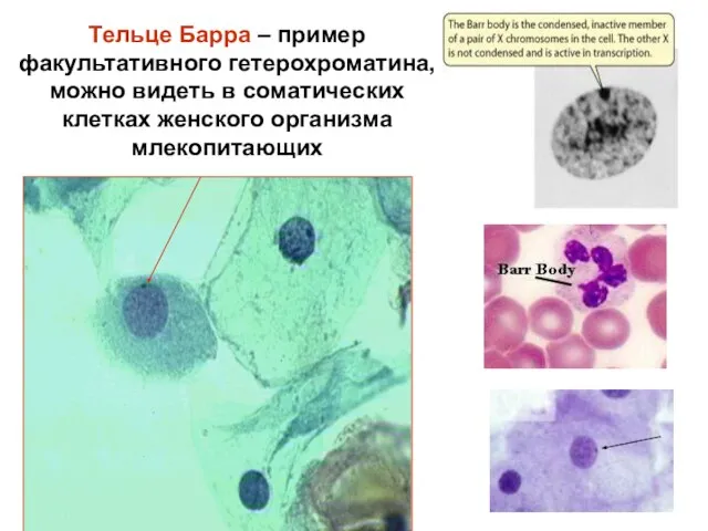 Тельце Барра – пример факультативного гетерохроматина, можно видеть в соматических клетках женского организма млекопитающих