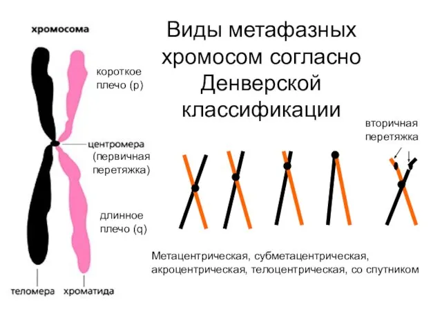 Виды метафазных хромосом согласно Денверской классификации Метацентрическая, субметацентрическая, акроцентрическая, телоцентрическая, со спутником