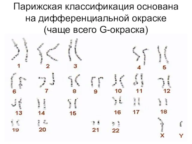 Парижская классификация основана на дифференциальной окраске (чаще всего G-окраска)