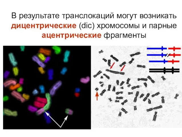 В результате транслокаций могут возникать дицентрические (dic) хромосомы и парные ацентрические фрагменты