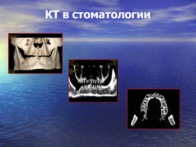 КТ в стоматологии