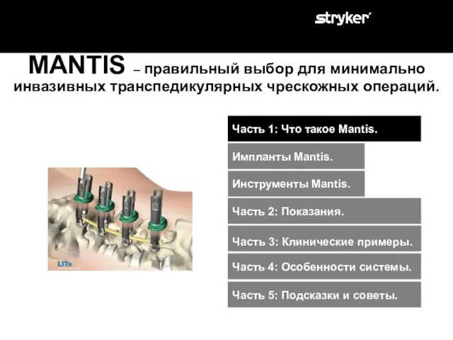 Часть 2: Показания. Часть 1: Что такое Mantis. Инструменты Mantis. Импланты Mantis.