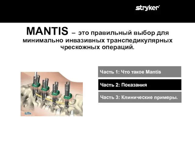 MANTIS – это правильный выбор для минимально инвазивных транспедикулярных чрескожных операций. Часть