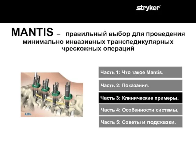 MANTIS – правильный выбор для проведения минимально инвазивных транспедикулярных чрескожных операций Часть