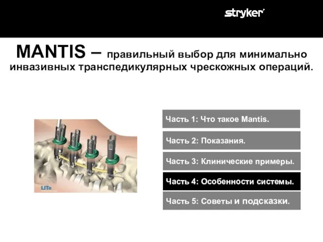 MANTIS – правильный выбор для минимально инвазивных транспедикулярных чрескожных операций. Часть 1: