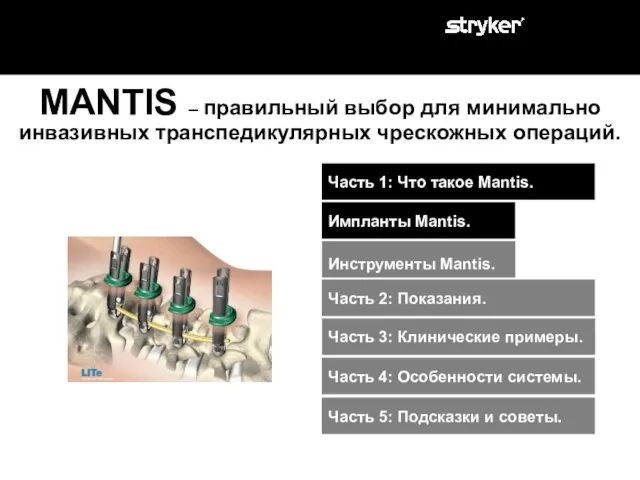 MANTIS – правильный выбор для минимально инвазивных транспедикулярных чрескожных операций. Часть 2: