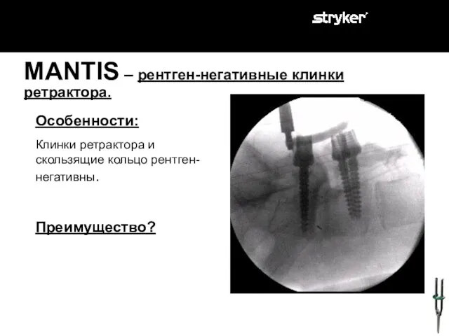 MANTIS – рентген-негативные клинки ретрактора. Особенности: Клинки ретрактора и скользящие кольцо рентген-негативны. Преимущество?