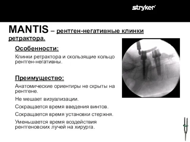 Особенности: Клинки ретрактора и скользящие кольцо рентген-негативны. Преимущество: Анатомические ориентиры не скрыты