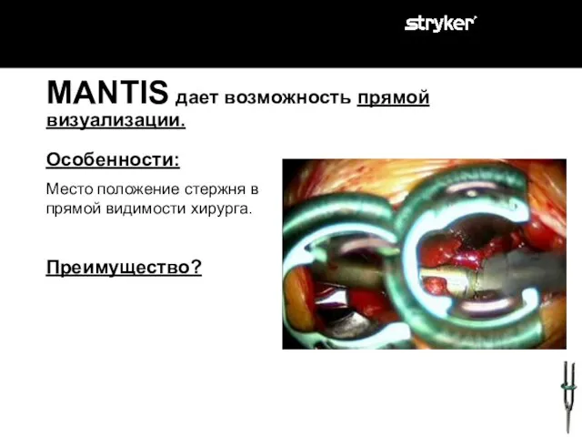 MANTIS дает возможность прямой визуализации. Особенности: Место положение стержня в прямой видимости хирурга. Преимущество?