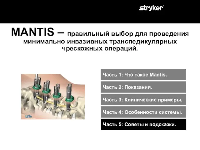 MANTIS – правильный выбор для проведения минимально инвазивных транспедикулярных чрескожных операций. Часть