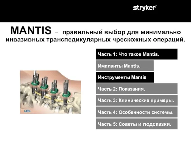 MANTIS – правильный выбор для минимально инвазивных транспедикулярных чрескожных операций. Часть 2: