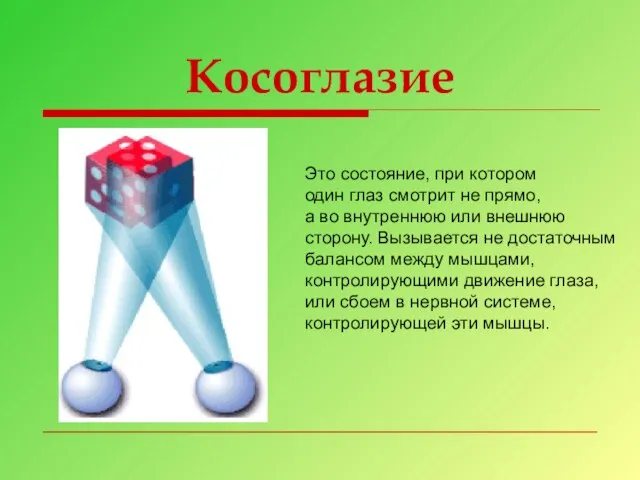 Косоглазие Это состояние, при котором один глаз смотрит не прямо, а во