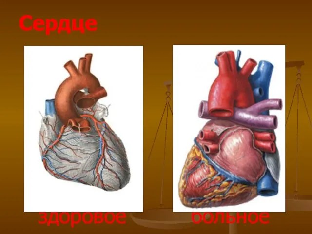 Сердце здоровое больное