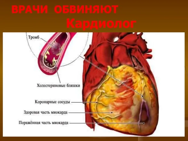 ВРАЧИ ОБВИНЯЮТ Кардиолог