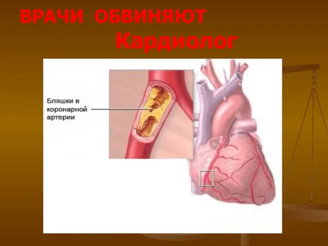 ВРАЧИ ОБВИНЯЮТ Кардиолог