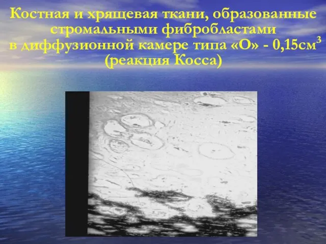 Костная и хрящевая ткани, образованные стромальными фибробластами в диффузионной камере типа «О» - 0,15см3 (реакция Косса)