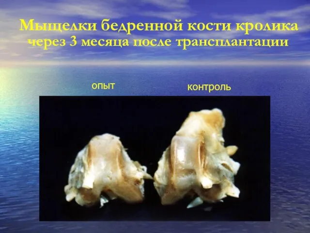Мыщелки бедренной кости кролика через 3 месяца после трансплантации контроль опыт