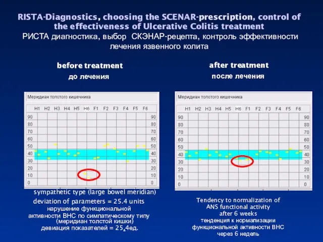 RISTA-Diagnostics, choosing the SCENAR-prescription, control of the effectiveness of Ulcerative Colitis treatment