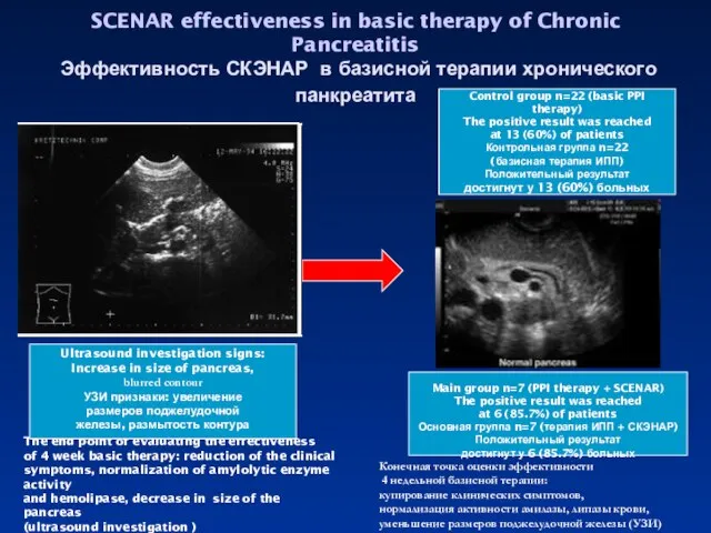 SCENAR effectiveness in basic therapy of Chronic Pancreatitis Эффективность СКЭНАР в базисной