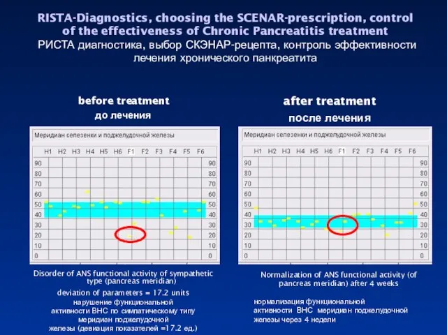 RISTA-Diagnostics, choosing the SCENAR-prescription, control of the effectiveness of Chronic Pancreatitis treatment