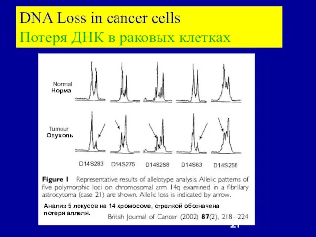 DNA Loss in cancer cells Потеря ДНК в раковых клетках