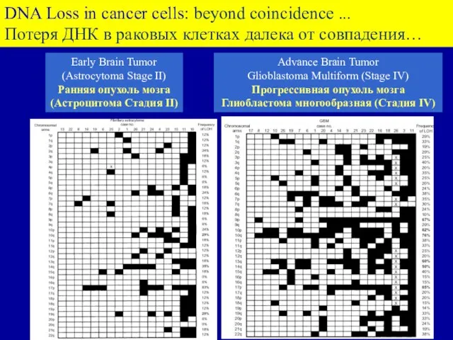 Early Brain Tumor (Astrocytoma Stage II) Ранняя опухоль мозга (Астроцитома Стадия II)