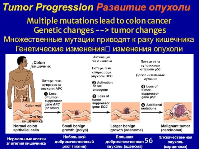 Multiple mutations lead to colon cancer Genetic changes --> tumor changes Множественные