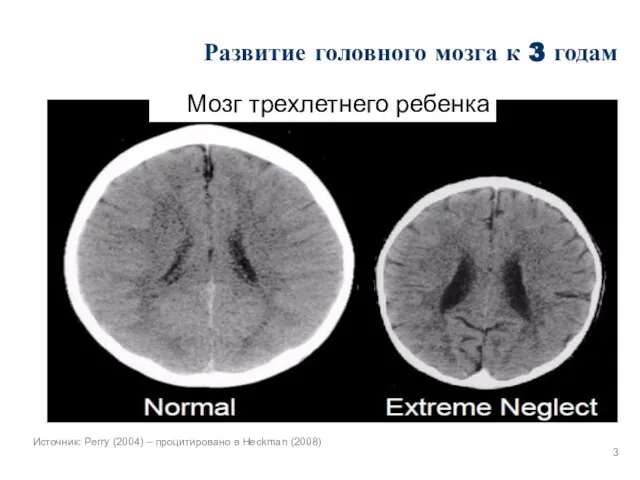 Развитие головного мозга к 3 годам Мозг трехлетнего ребенка Источник: Perry (2004)