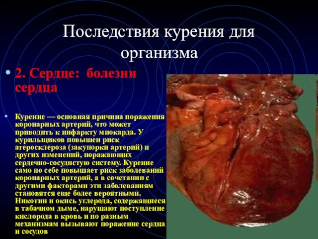 Последствия курения для организма 2. Сердце: болезни сердца Курение — основная причина