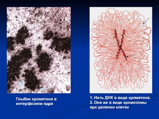 Глыбки хроматина в интерфазном ядре 1. Нить ДНК в виде хроматина. 2.