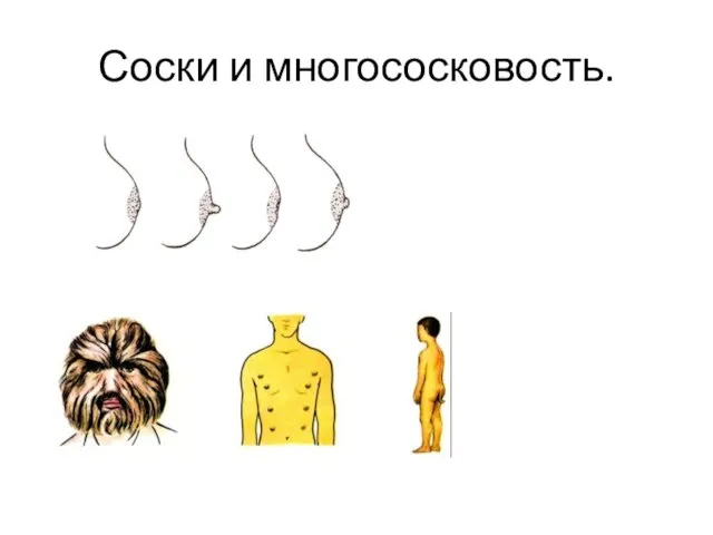 Соски и многососковость.