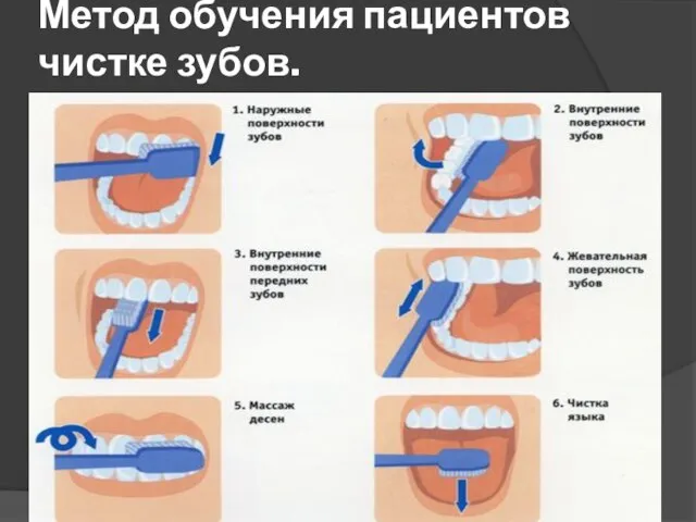 Метод обучения пациентов чистке зубов.