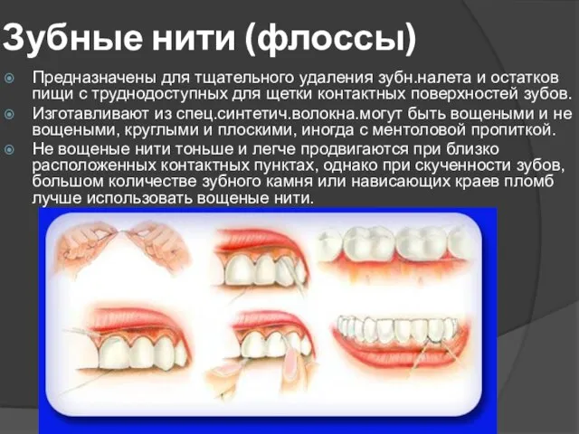 Зубные нити (флоссы) Предназначены для тщательного удаления зубн.налета и остатков пищи с