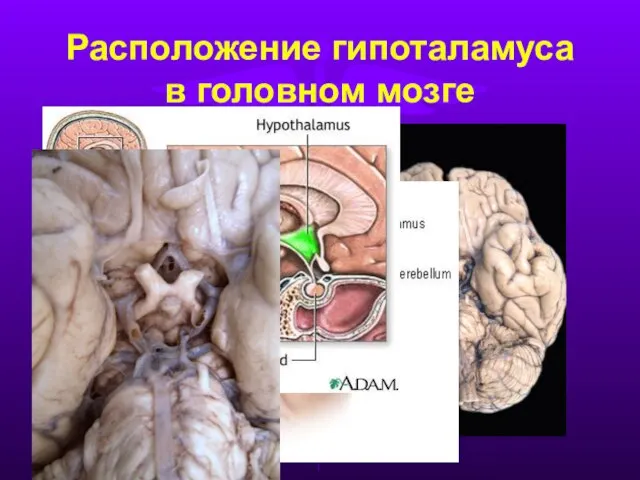 Расположение гипоталамуса в головном мозге