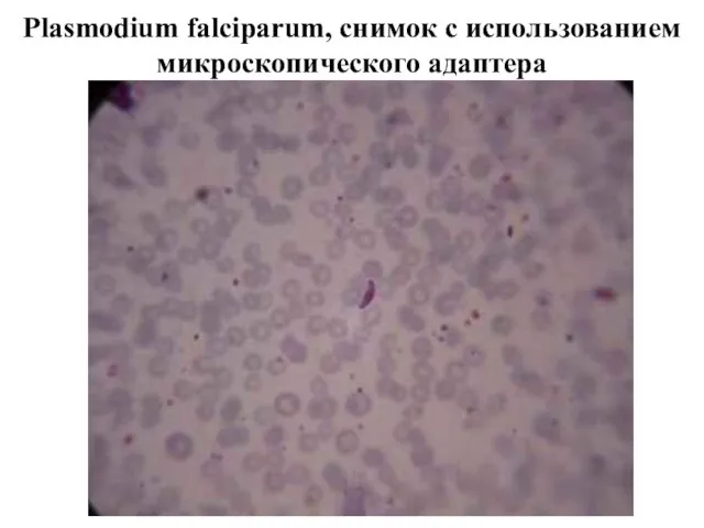 Plasmodium falciparum, снимок с использованием микроскопического адаптера