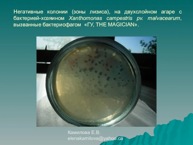 Камилова Е.В. elenakamilova@yahoo.ca Негативные колонии (зоны лизиса), на двухслойном агаре с бактерией-хозяином