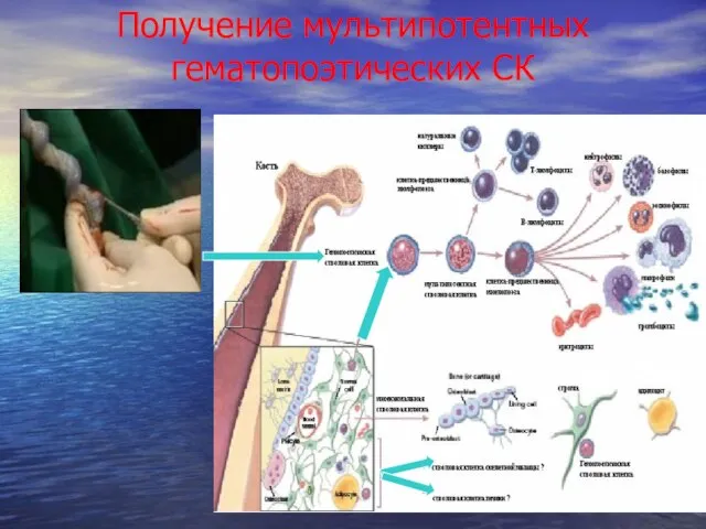 Получение мультипотентных гематопоэтических СК