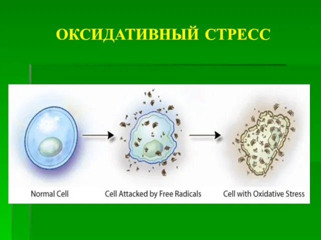 ОКСИДАТИВНЫЙ СТРЕСС