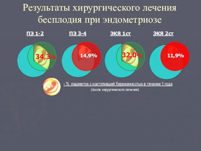 Результаты хирургического лечения бесплодия при эндометриозе ПЭ 1-2 ПЭ 3-4 ЭКЯ 1ст