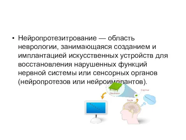 Нейропротезитрование — область неврологии, занимающаяся созданием и имплантацией искусственных устройств для восстановления