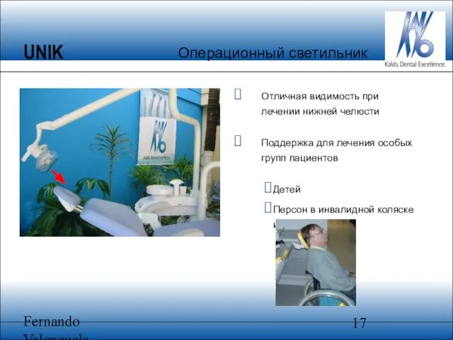 Fernando Valenzuela Отличная видимость при лечении нижней челюсти Поддержка для лечения особых