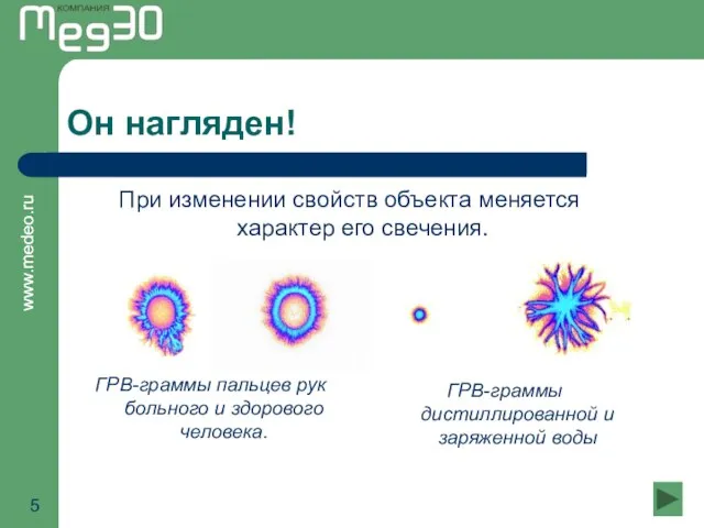 Он нагляден! При изменении свойств объекта меняется характер его свечения. ГРВ-граммы пальцев